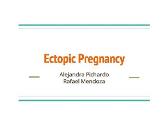 About Ectopic Pregnancy