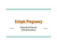 About Ectopic Pregnancy PowerPoint Presentation