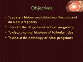 Ectopic Pregnancy