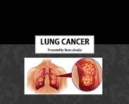 Lung Cancer PowerPoint Presentation Notes