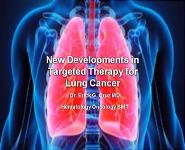 Therapy for Lung Cancer  PowerPoint Presentation