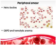 Lab Unterpretation PowerPoint Presentation