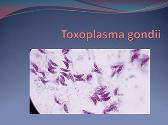 Toxoplasma Gondii
