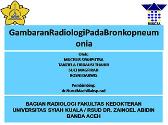 Gambaran Radiologi Pada Bronkopneumonia