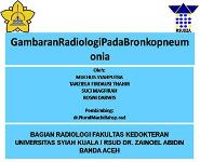 Gambaran Radiologi Pada Bronkopneumonia PowerPoint Presentation Notes