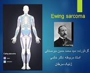Ewing Sarcoma Family Tumors PowerPoint Presentation