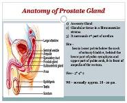 Benign Prostatic Hypertrophy BPH PowerPoint Presentation