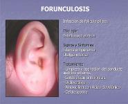 OTALGIA PowerPoint Presentation