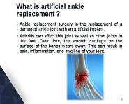 mri PowerPoint Presentation