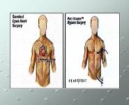 Robotic Surgery PowerPoint Presentation