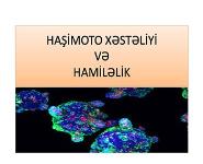 Hasimoto X PowerPoint Presentation Notes