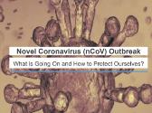 Novel Coronavirus (nCoV) Outbreak – Symptoms, Precautions and Treatment