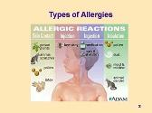 Allergies Allergens and Food Handlers
