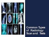 Common Types of Radiology Scan and Tests