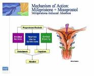 Overview of Medical Abortion-Clinical and Practice Issues PowerPoint Presentation