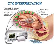 CTG interpretation PowerPoint Presentation